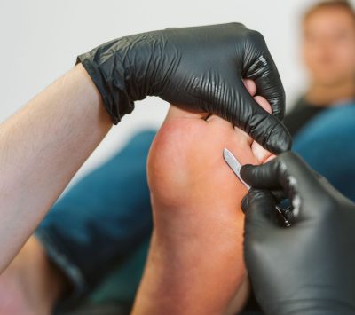 Kiedy pedicure kosmetyczny nie wystarcza - rola podologa w dbaniu o stopy.4